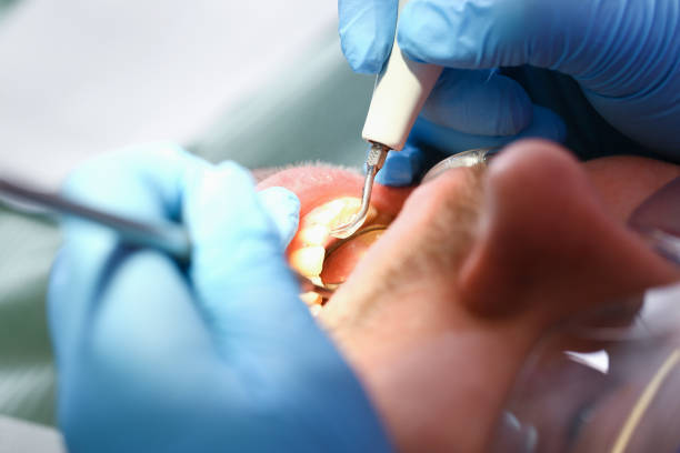 Best Emergency Broken Tooth Repair in East Uniontown, PA